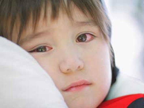 Khuyến cáo phòng bệnh đau mắt đỏ